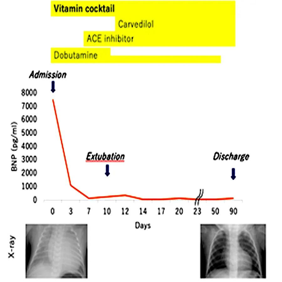 barth综合征,bartter综合征治疗