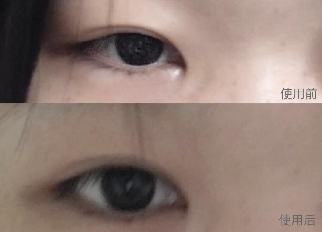 欧阳娜娜关晓彤眼霜,欧阳娜娜眼霜去黑眼圈