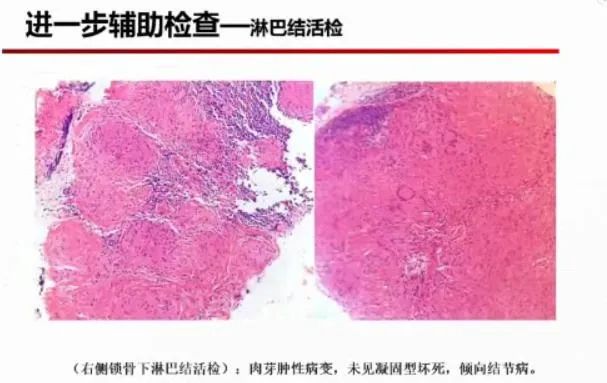 病例学习分享,病例分享第四期
