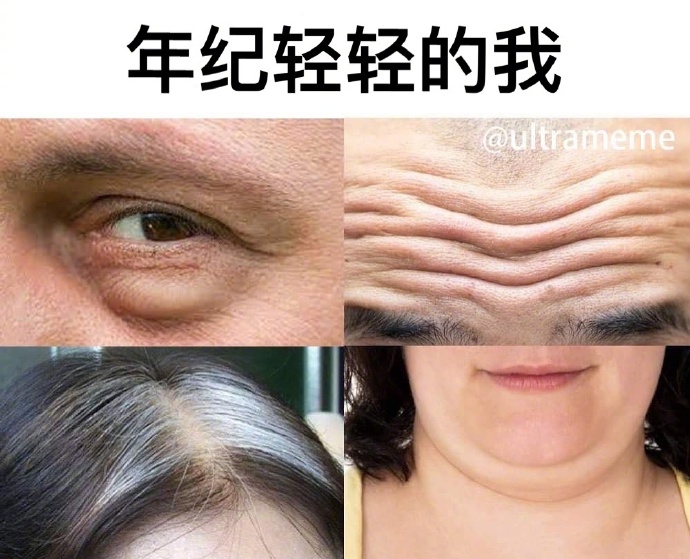 汪苏泷的脸摔肿了,汪苏泷脸肿成蜜蜂小狗