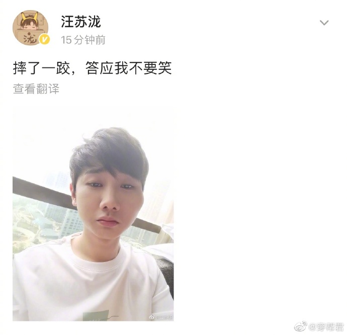 汪苏泷脸摔肿,汪苏泷的脸摔肿了