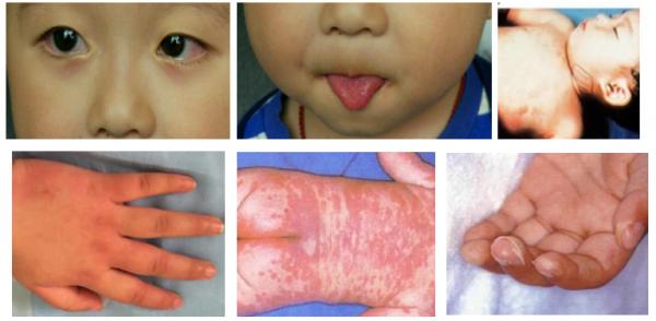 怀化市肿瘤医院怀化第二人民医院,怀化肿瘤医院最新视频