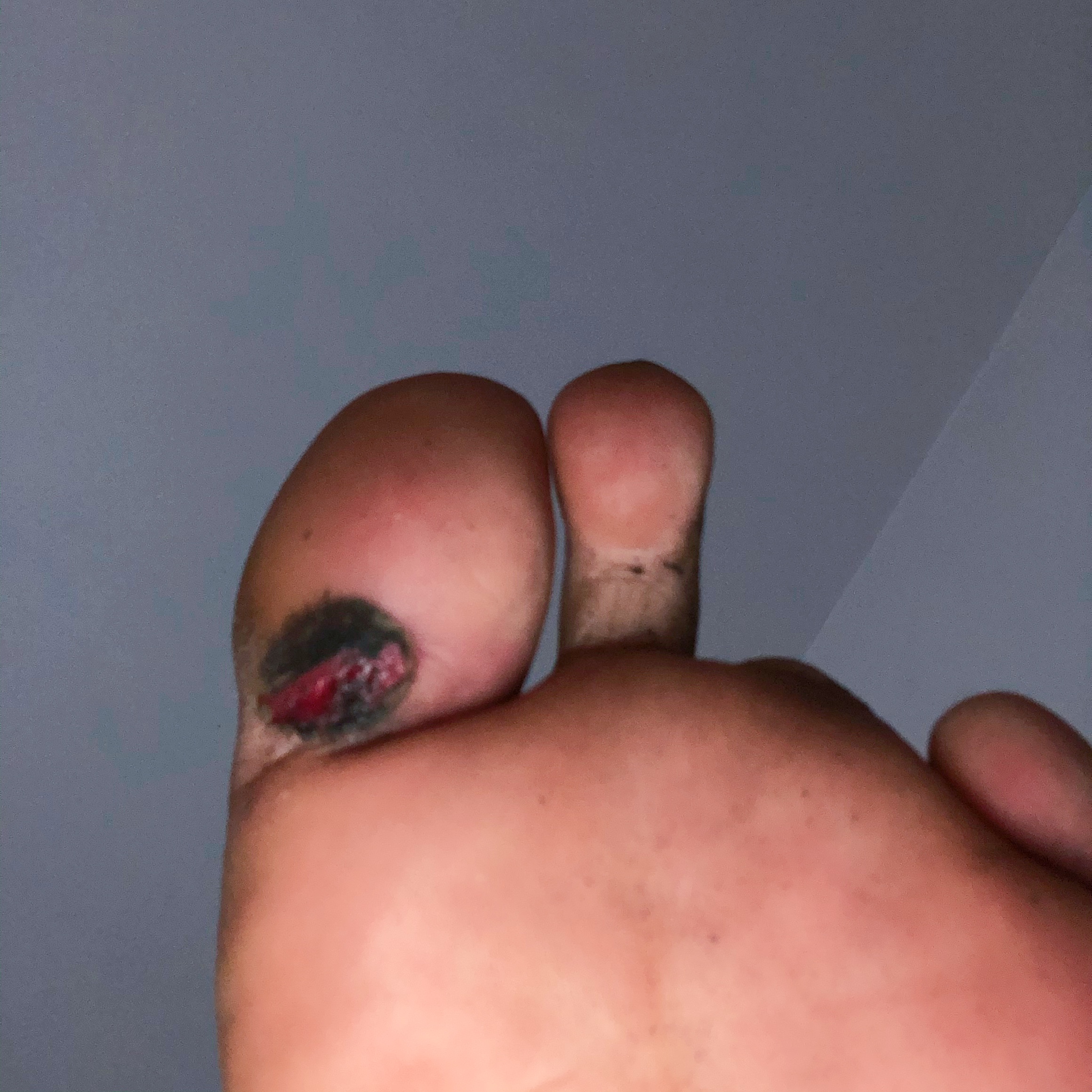 王鹏夺冠经历,王鹏夺冠