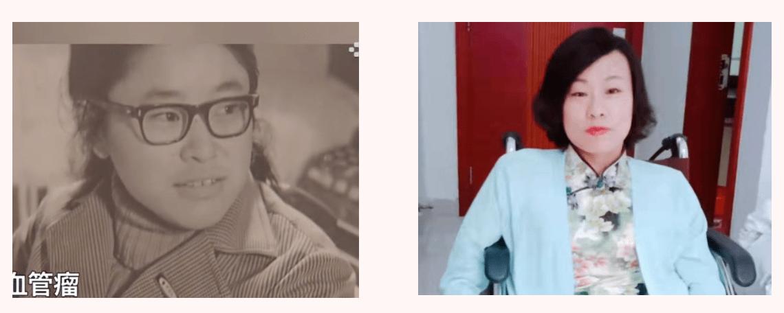 看见她好像又一个“张海迪”来了