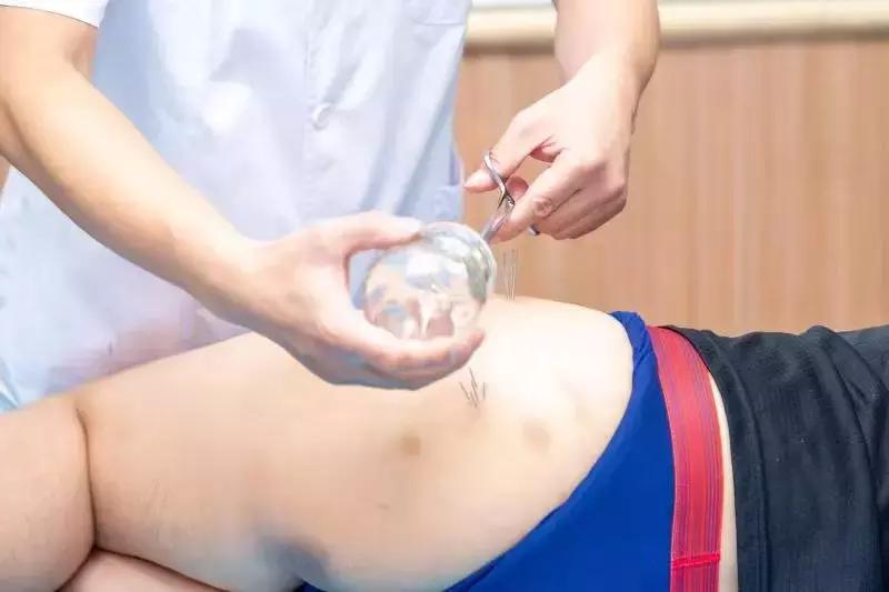 五虎擒羊是指什么穴位,五虎擒羊针法