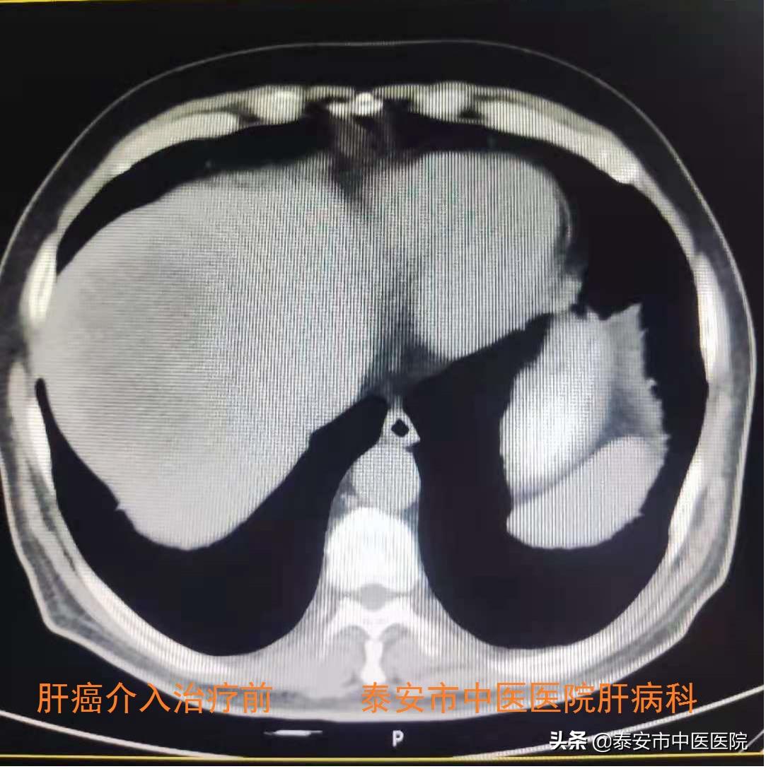 传承精华守正创新市中医医院,中医药大学第一附属医院肝病科