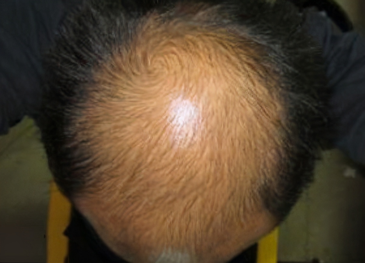 牙龈痛是心脏病的前兆吗,牙龈肿痛和心脏病有关系么