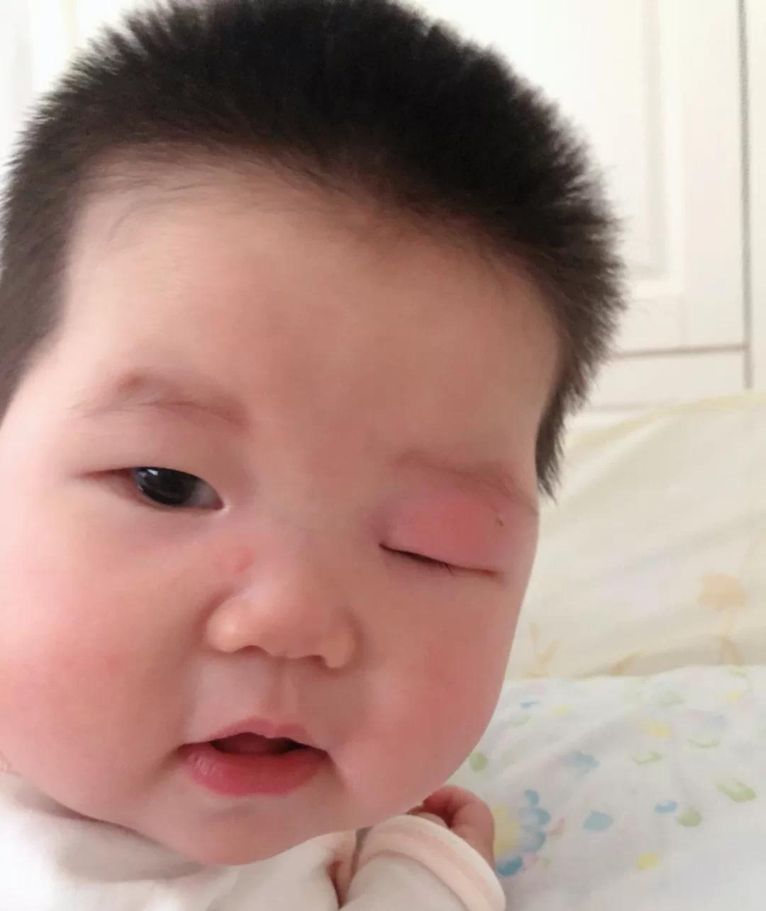 宝宝有蚊子咬搞什么驱蚊,宝宝总被蚊子咬怎么有效驱蚊