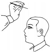 中风后遗症三针疗法,焦顺发靶向定位头针疗法