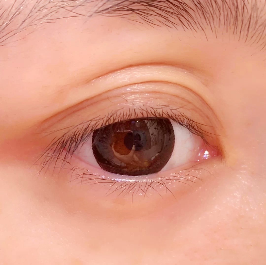 三眼皮和双眼皮哪个好看,三眼皮和二眼皮好看吗