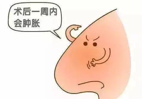 隆鼻慎重,选择整形医院注意什么