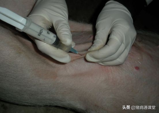 皮下静脉输液教学,皮下注射方法和位置