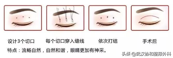 上海九院整形和协和整形,北京协和整形医院美容整形价格