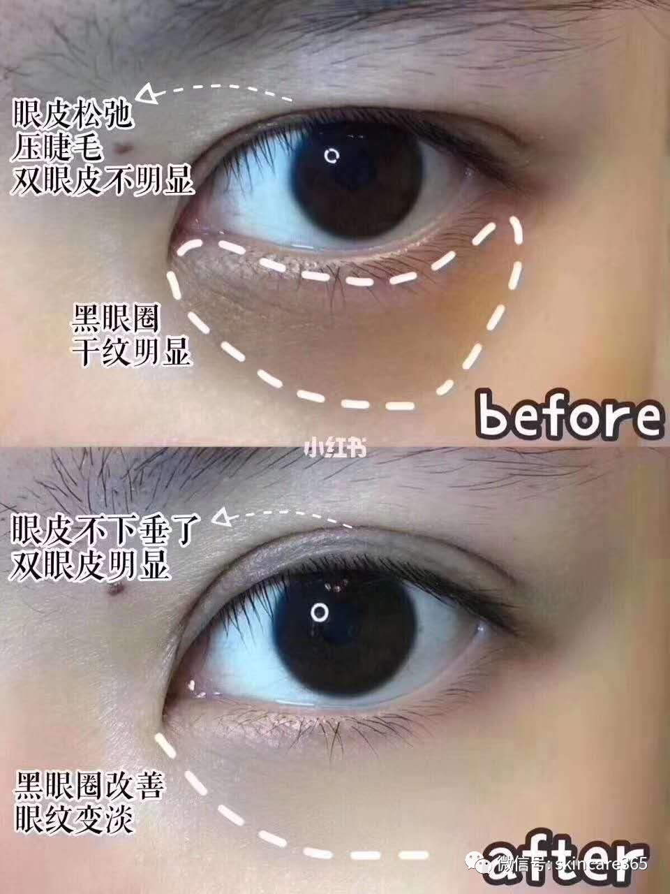 日本晓姿眼膜功效,晓姿眼膜使用方法