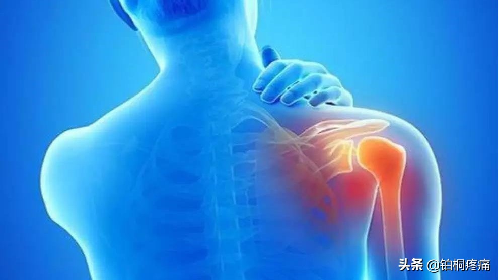 肩不举,肩周炎严重手抬不起最佳治疗办法
