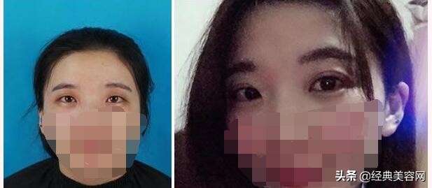 宁波整形医院第一名是哪家,宁波薇琳整形口碑怎么样