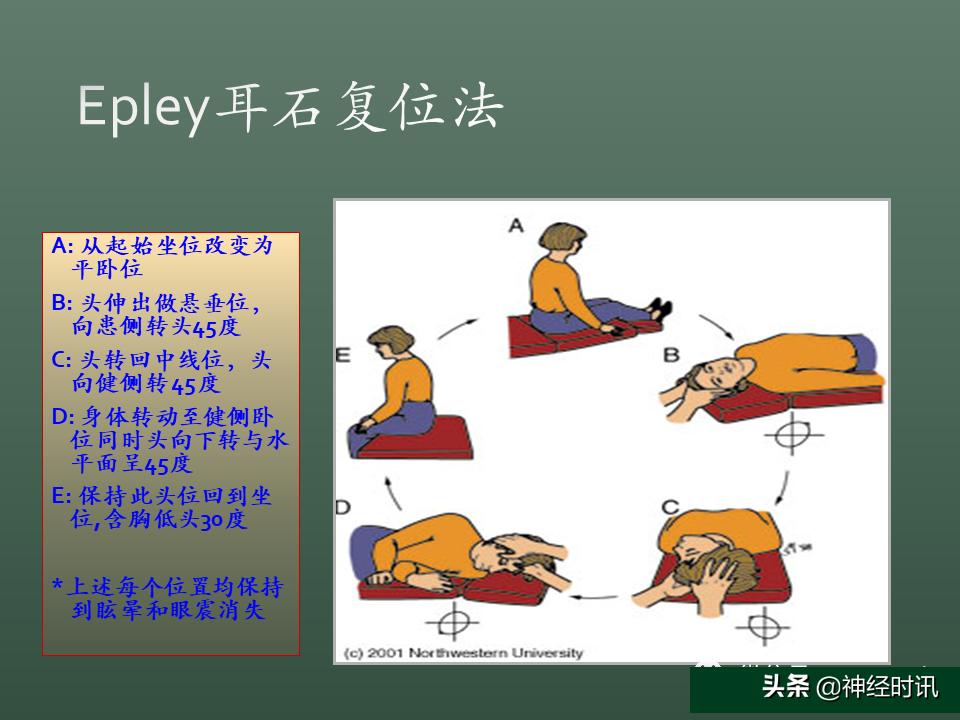 良性位置性眩晕诊断和治疗指南,良性阵发性位置性眩晕的诊断标准