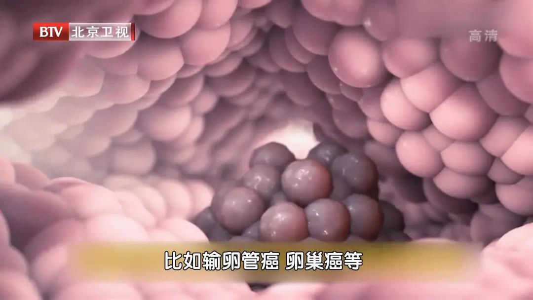 子宫肌瘤是切除好还是保留好,子宫肌瘤建议多少岁要切掉