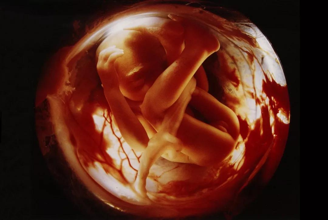 哈医大一院子宫肌瘤专家,子宫肌瘤疾病大全专家解析有声版