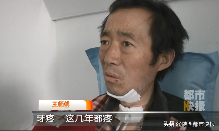 男子牙疼出脓液,男子牙疼去医院检查发现虫子