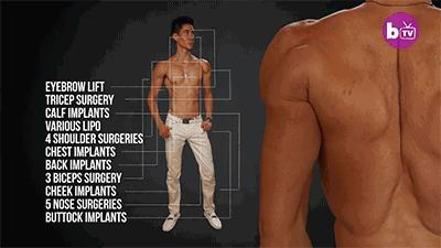 关于隆胸手术你想知道的那些事,隆胸丰臀整形