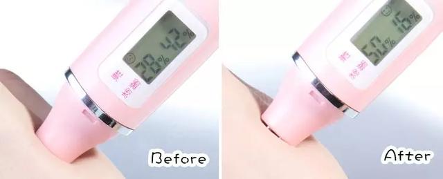 脂肪粒应该怎样用针挑,脂肪粒用针挑越挑越多