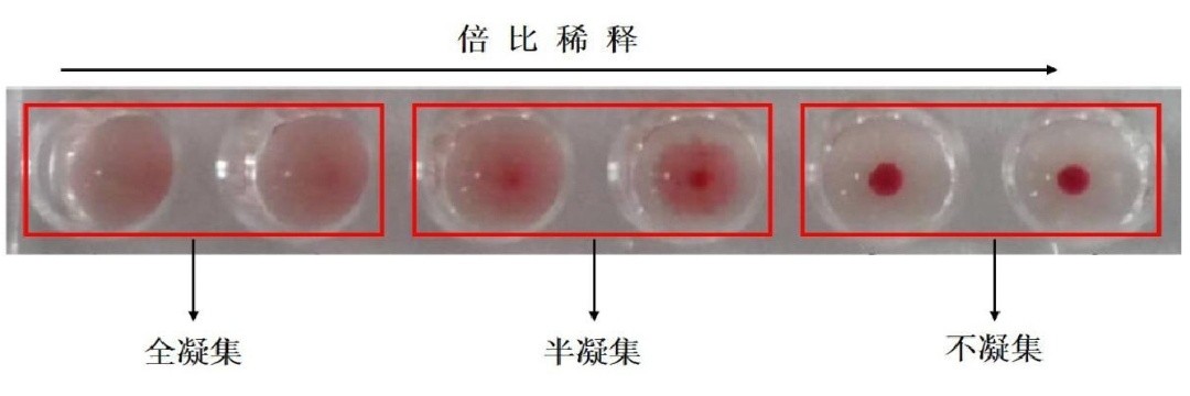 四季豆轻微中毒会头晕,四季豆轻微中毒症状怎么处理