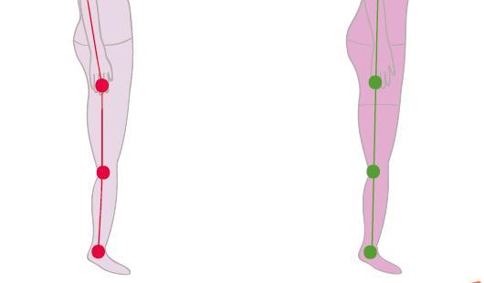 含胸驼背脖子前倾如何改善正骨,脖子前倾驼背最快纠正法