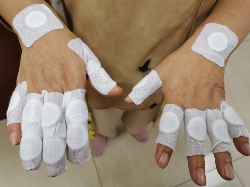 中医三伏贴冬病夏治正当时,冬病夏治正当时快来预约三伏贴