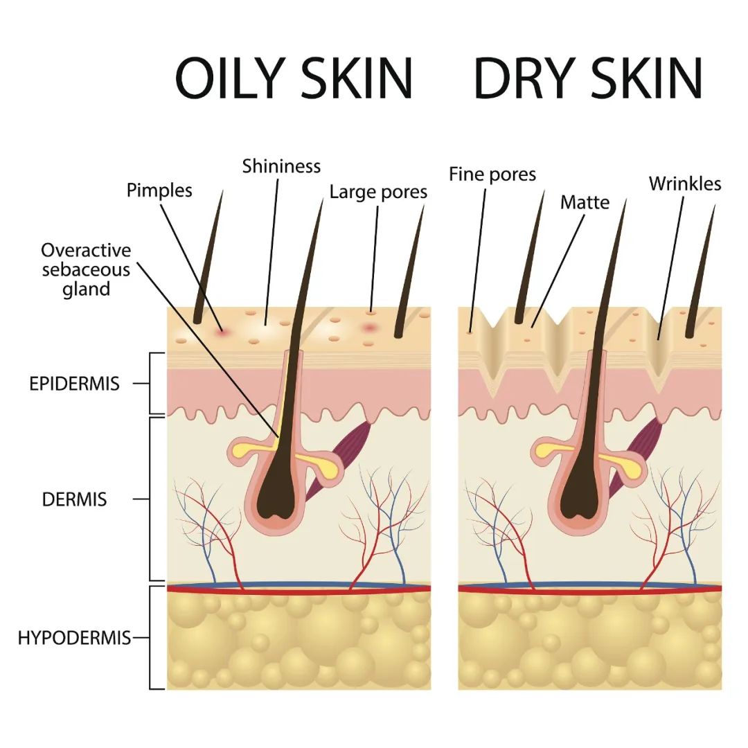 收缩毛孔轻松说拜拜,收缩毛孔不反弹最好的办法是什么