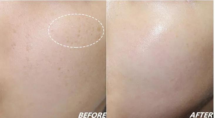 长斑的女性如何护肤有效,有效的祛色斑小方法