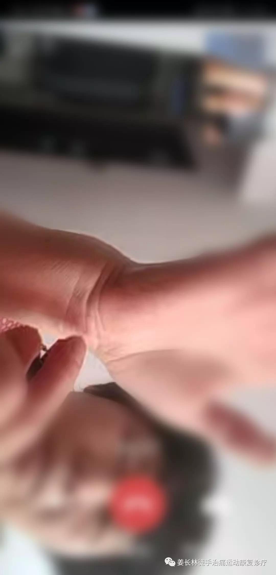 日常生活中的疼痛1—手麻(长时间玩手机)的判断和自我纠正