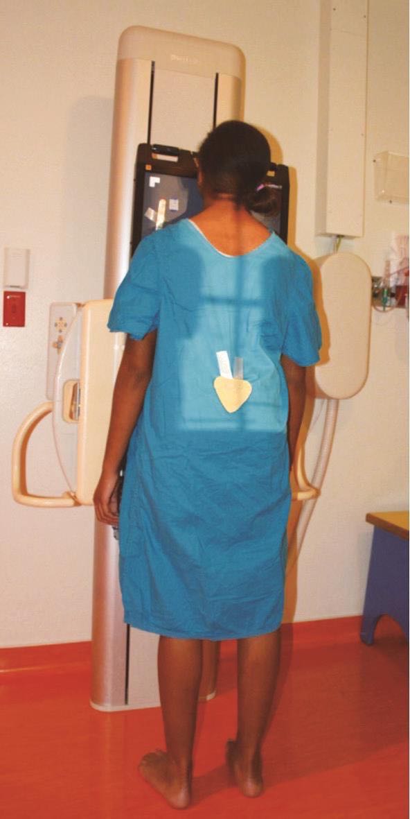 医院x射线危害,如何检测人员受没受x射线辐射