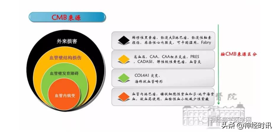 缺血性脑血管病出血评估,脑血管微出血怎么治疗