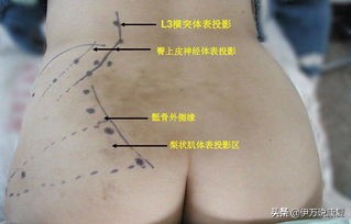 腰疼治不好怎么办,腰疼一定是腰椎出问题了吗