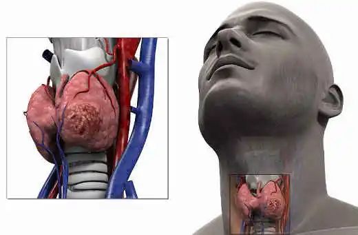 手术根治能彻底治愈吗,手术做不好怎么处理