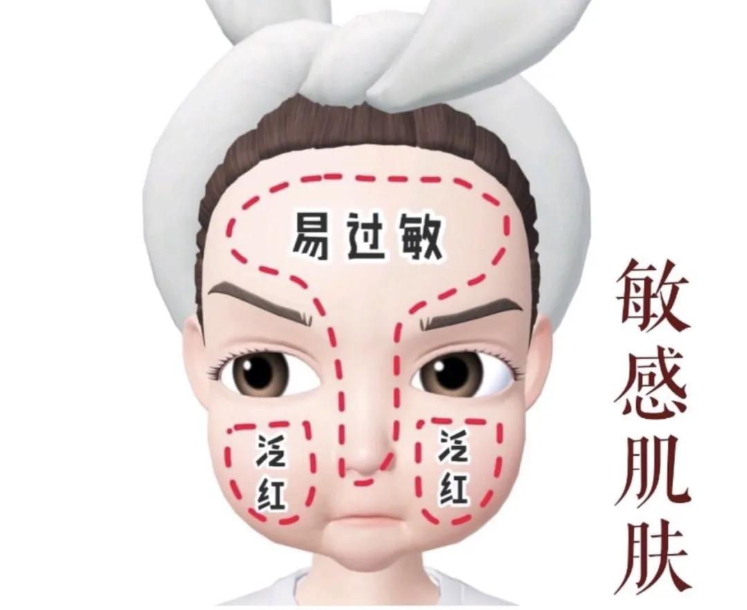 t区出油是什么肤质两颊起皮,冬天鼻子两颊起皮是什么肤质