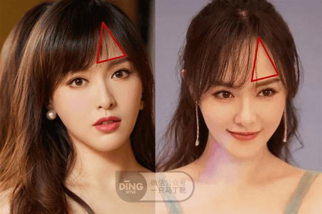 太阳穴凹陷颧骨突出是什么发型,额头窄太阳穴凹陷颧弓突出的发型