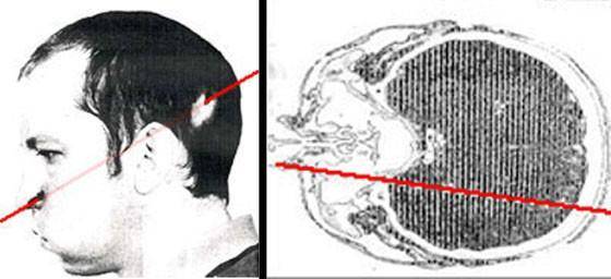他被高能质子束直接爆头，几十年过去，被辐射的左脸依旧年轻