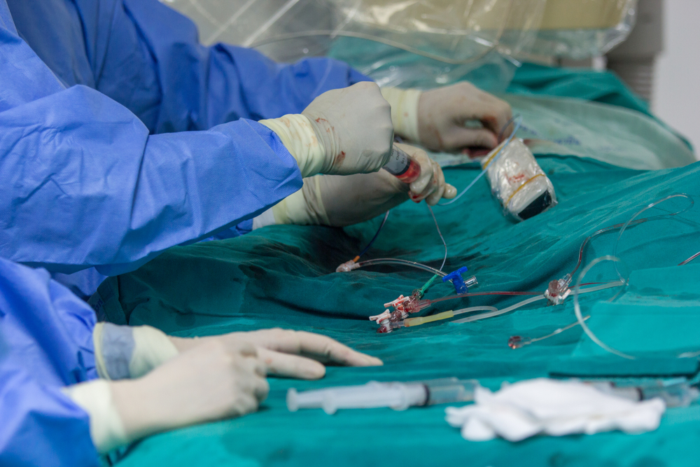 心脏造影十大危害是真的吗,心脏造影的绝对禁忌症有哪些