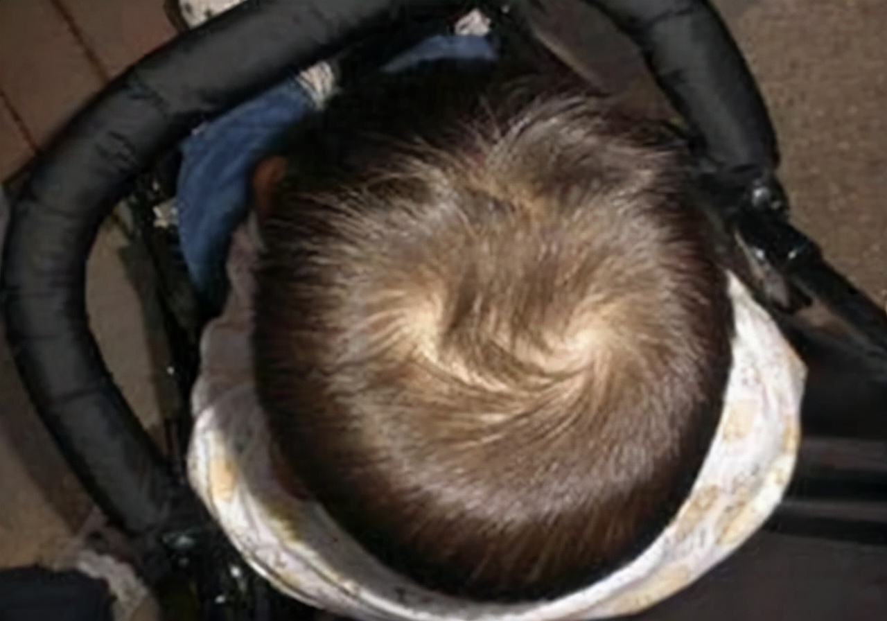 孩子头上的旋代表什么意思,孩子头上的旋到底和什么有关