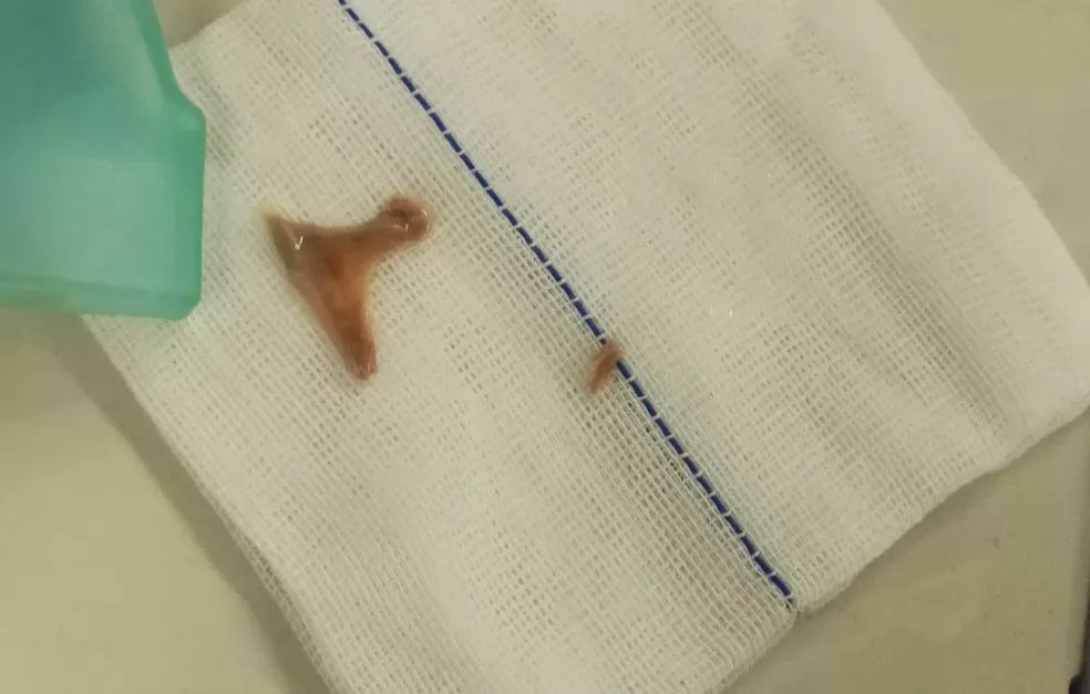 一只鸭引发血案,一只鸭引发的血案