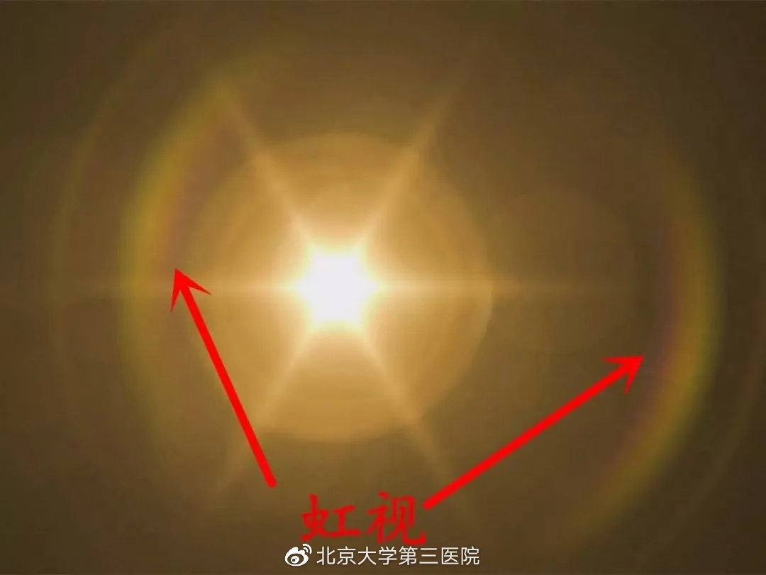 视野不丢，生活无忧|“大夫，我最近看灯光时四周总是有彩虹一样的七彩光晕，有问题吗？”