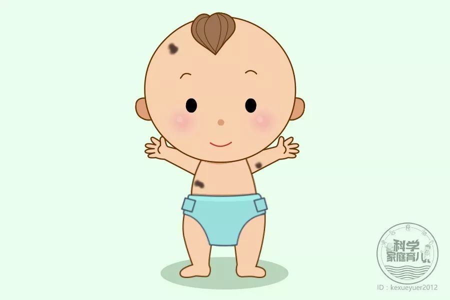 如何避免婴儿脸上胎记和长痣,胎记痣形成的原因