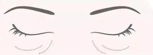 你的黑眼圈找到救星了吗,你的黑眼圈可能都是它惹的祸