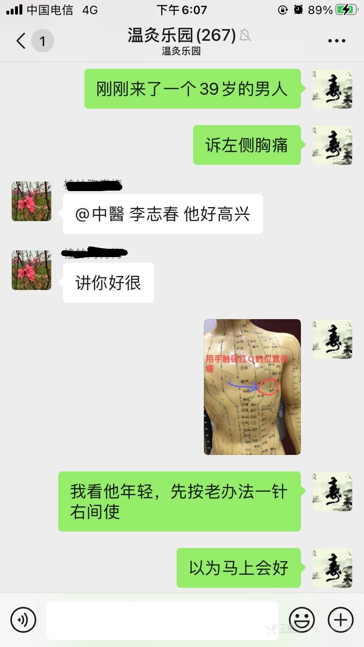 胸痛针灸哪些穴位可以治,董氏针灸治疗岔气胸痛