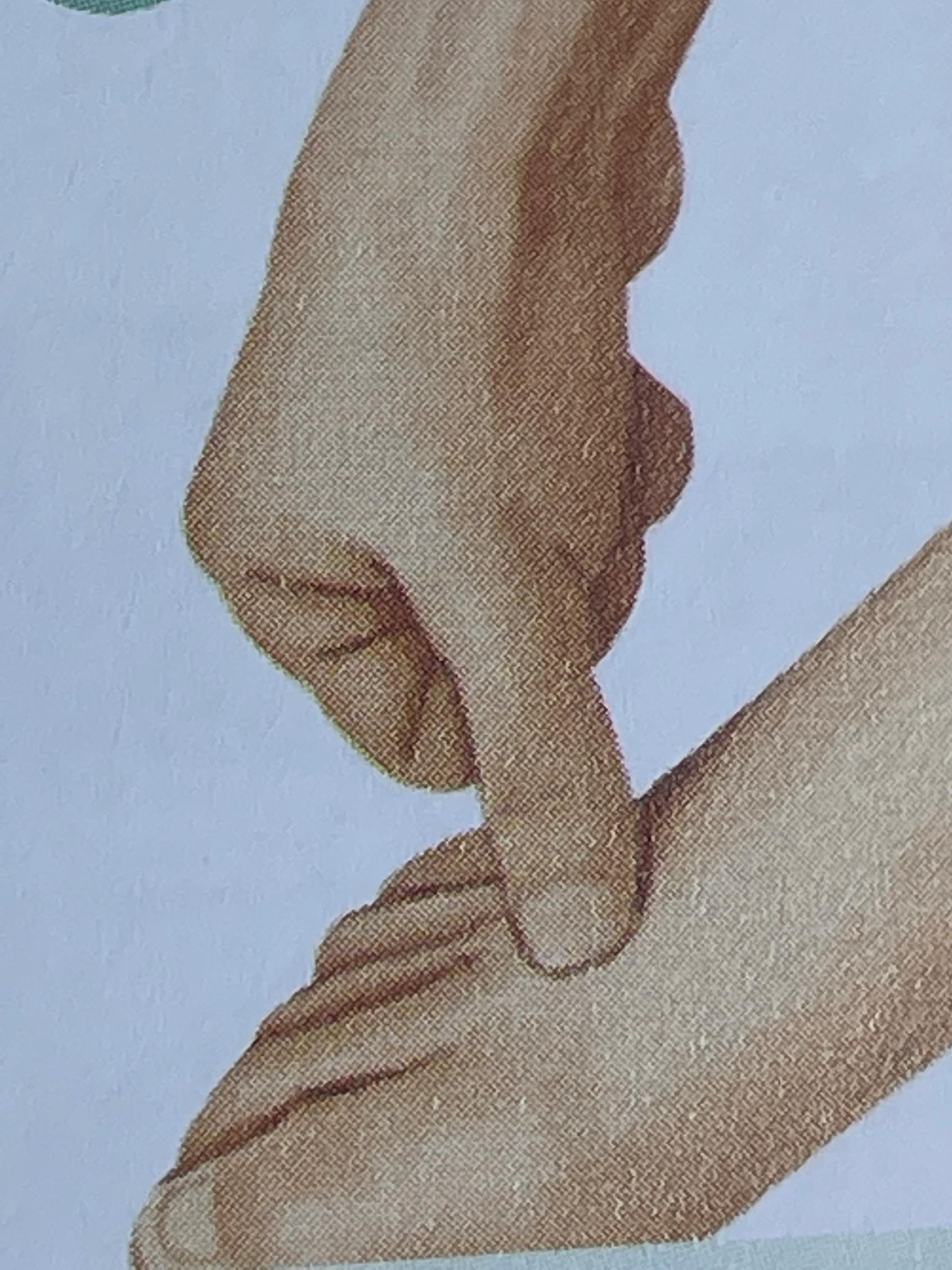 乳腺增生结节怎么办啊,乳腺增生结节怎么办呢