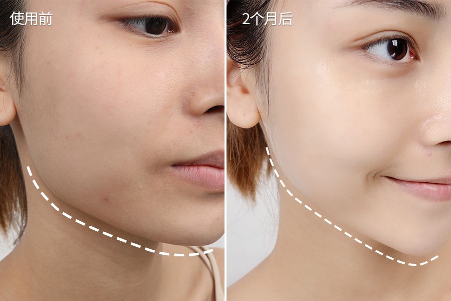 琚佸濮楄憽钀勭苯绮惧崕,琚佸濮楁帹鑽愯憽钀勭苯鎶よ偆