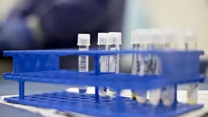 澳洲保健品介绍一览表,为什么澳洲保健品被认可