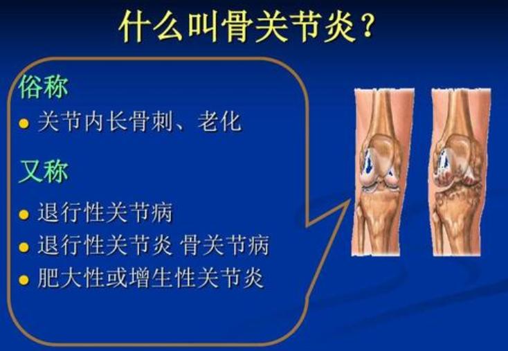 “骨头老了”怎么办?要补钙吗?医生说:有些需要补,有些不需要